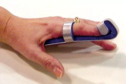 Baseball Finger Splint Small BulkPK/6 Non-Retail
