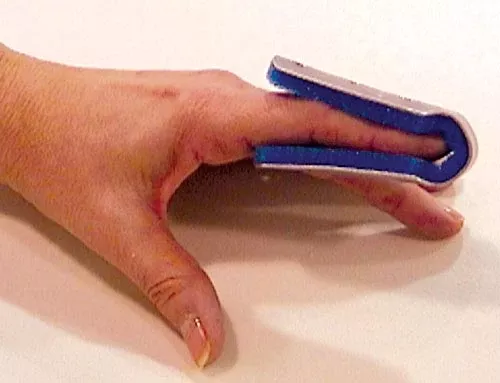 Fold Over Finger Splint Large BulkPK/6 Non-Retail