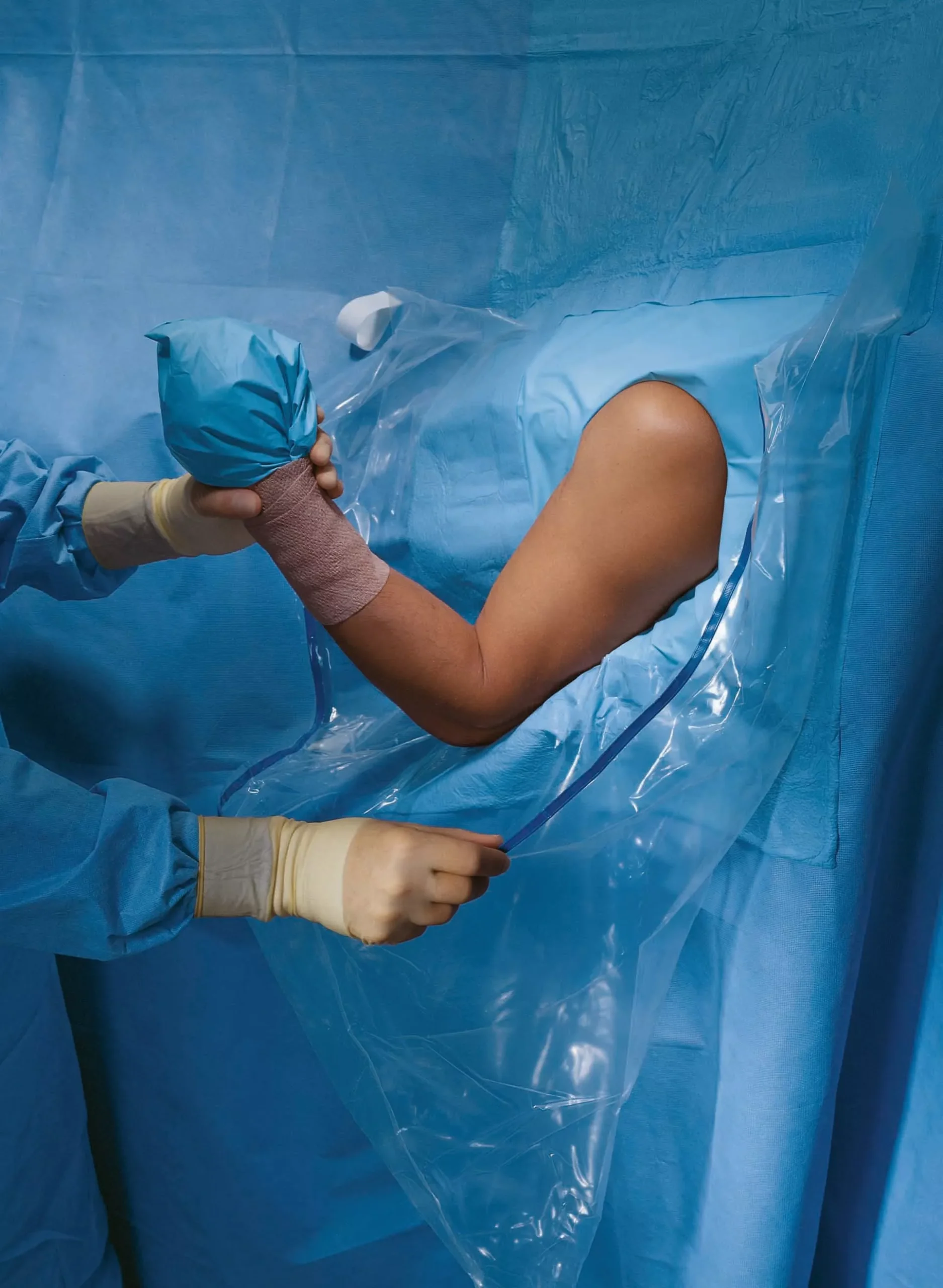 Halyard Sterile Shoulder Arthroscopy Orthopedic Drape, 160 W x 102 L Inch, 1 Each