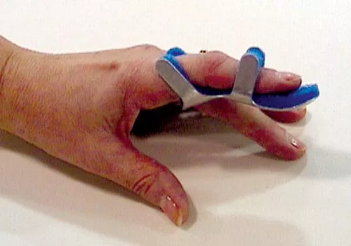Toad Finger Splint Large BulkPK/6 Non-Retail